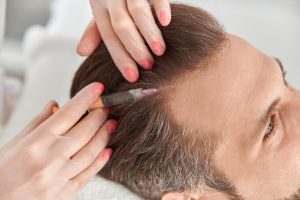 Como a terapia capilar trata problemas do couro cabeludo?